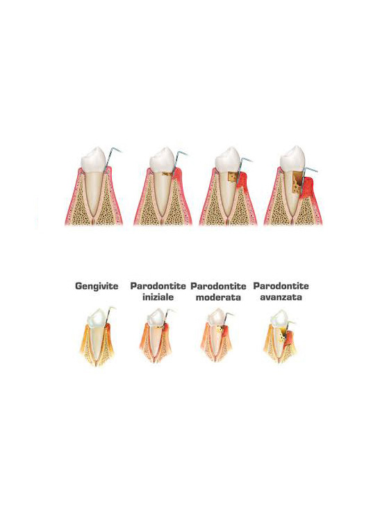 Parodontologia